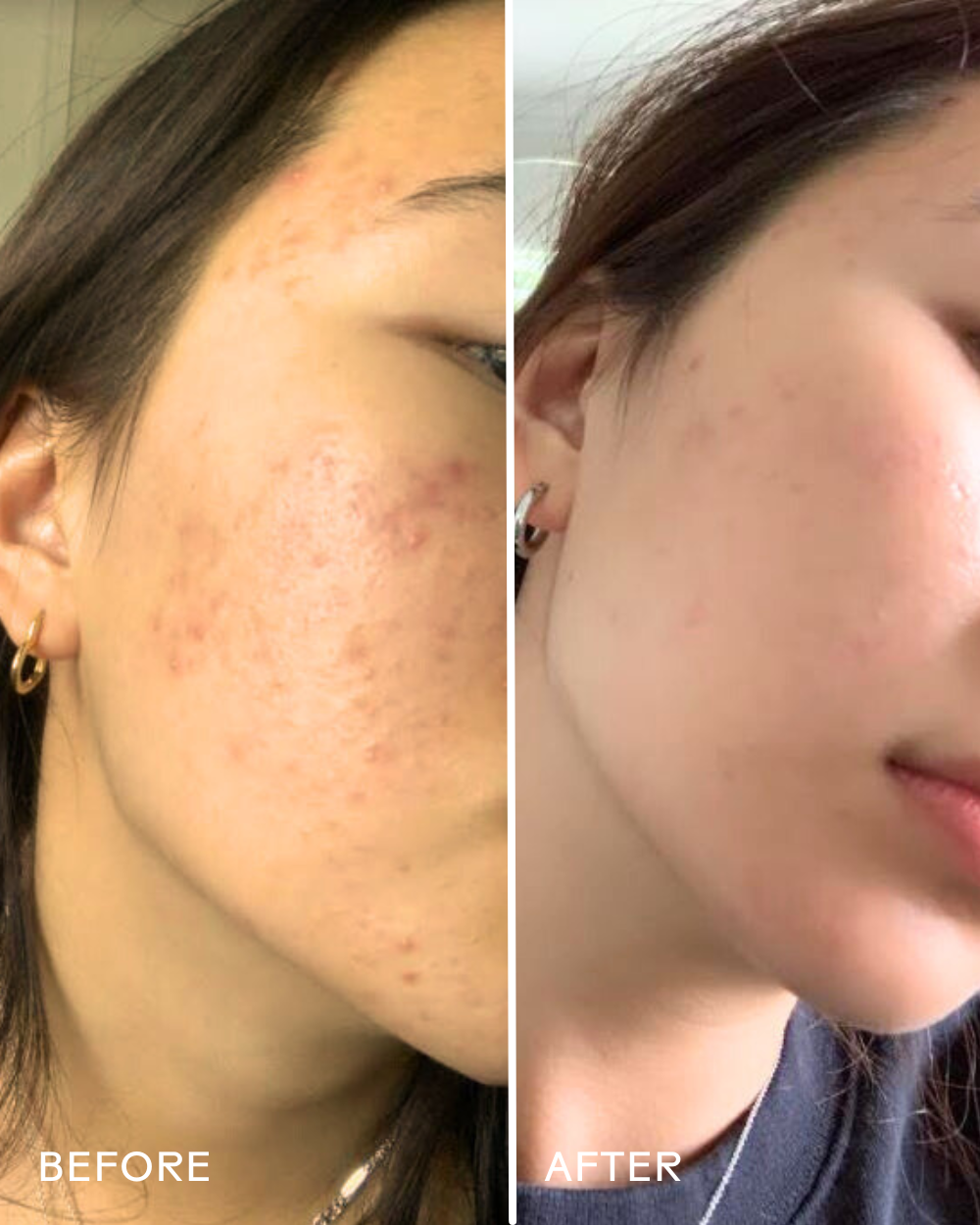 Purify Aloe + Amino Acid Gel Cleanser