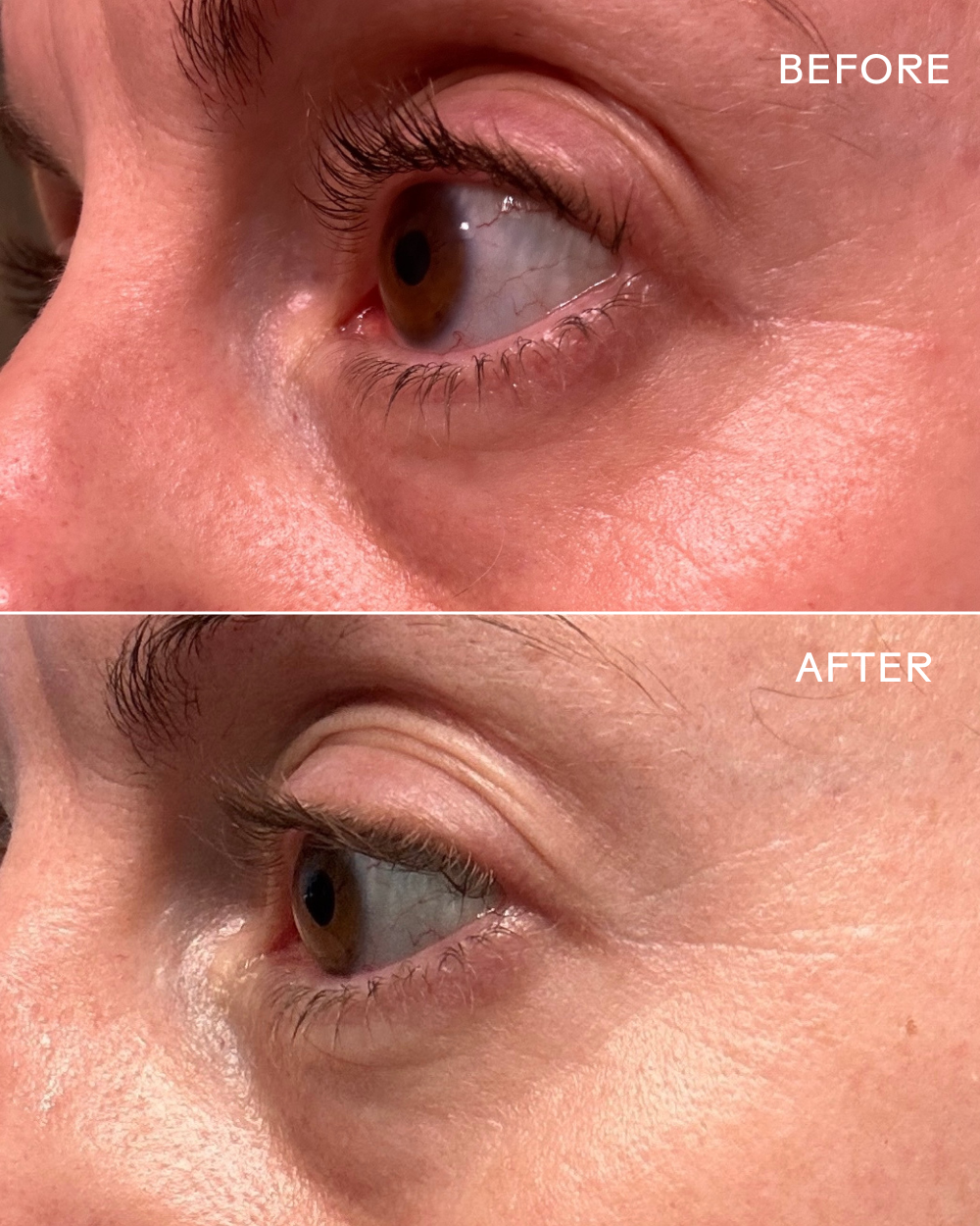 Three Ships Eye Hero Bio-Retinol Smoothing Eye Cream